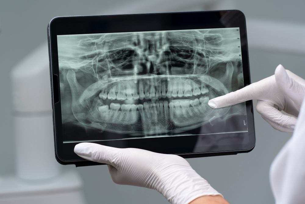 Digital X-Rays  Little Elm, TX
