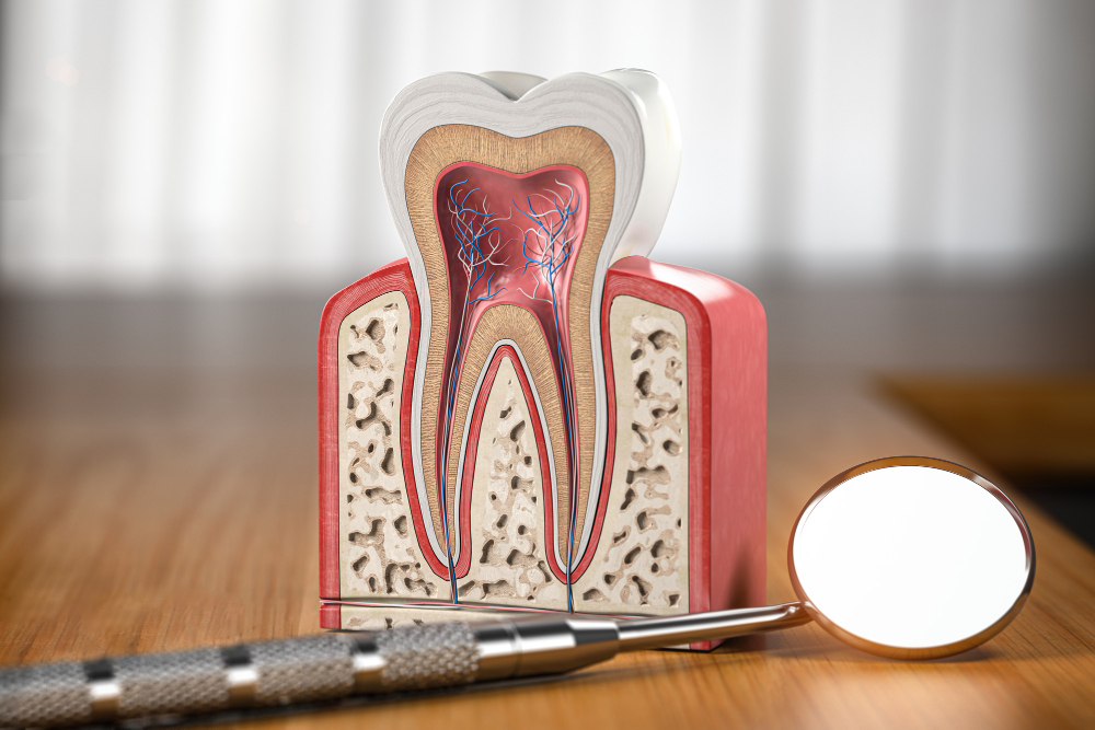 Root Canals in Little Elm